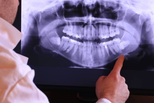 Best Emergency Treatment for Dental Infections or Abscesses in Pegram, TN