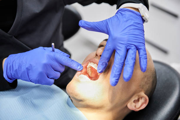 Best Emergency Dental Care for Broken or Chipped Teeth in Pegram, TN